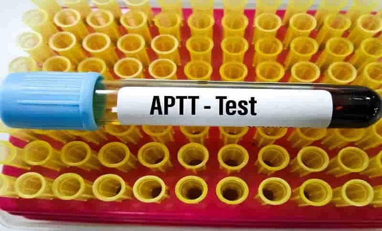 aPTT Testi